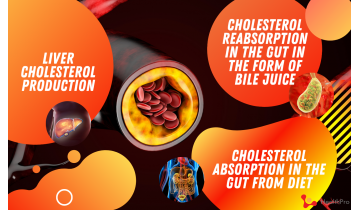 Fight High Cholesterol Levels at the Root Causes
